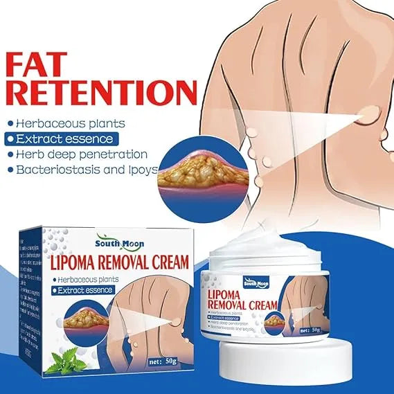 South Moon Lipoma Removal Cream ( Buy 1 Get 1 Free )
