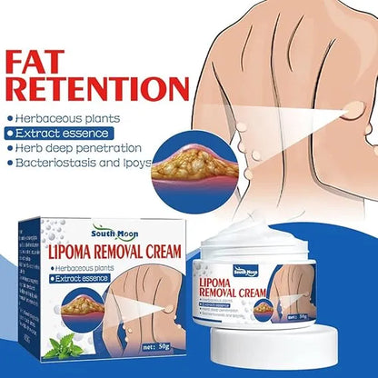 South Moon Lipoma Removal Cream ( Buy 1 Get 1 Free )